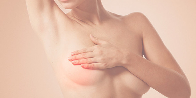 Reconstruction mammaire par lambeau, une alternative aux implants